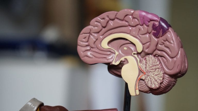 The Mind-Body Connection